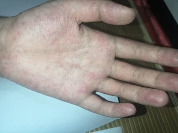 product-1-1 product-1-1