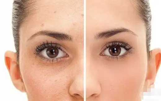 product-1-1 product-1-1