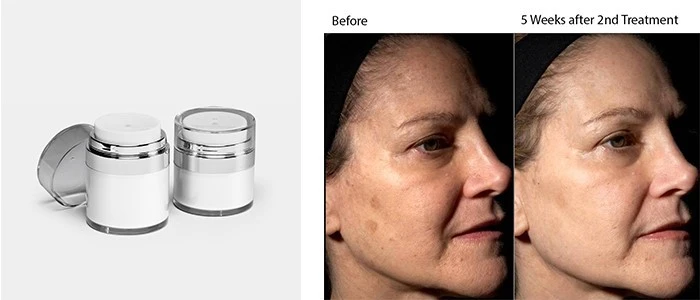 product-1-1 product-1-1