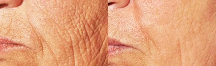 product-1-1 product-1-1